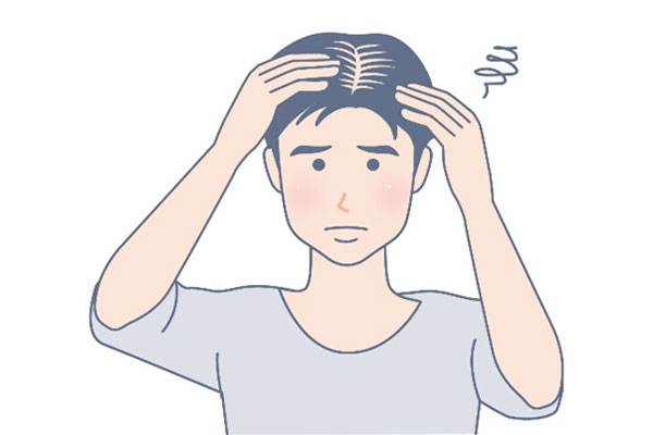 男性の薄毛・抜け毛でお悩みの方へ 五泉皮ふ科のAGA治療