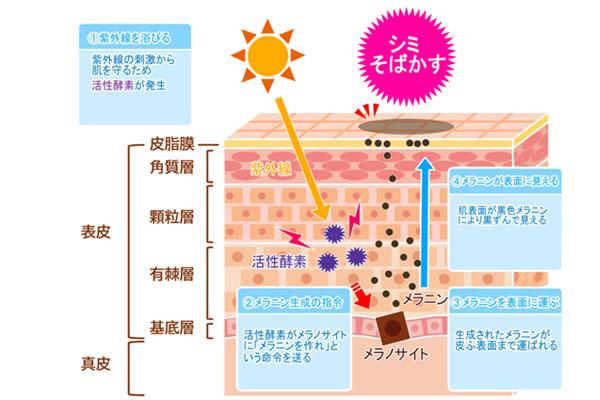 シミの種類と原因