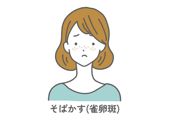 そばかす（雀卵斑）