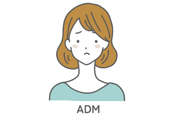 ADM（後天性真皮メラノサイトーシス）