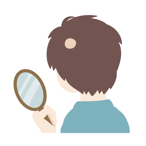 円形脱毛症の原因