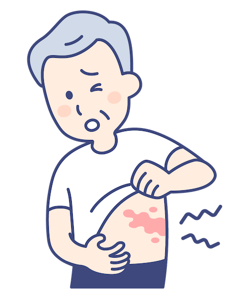 帯状疱疹の原因