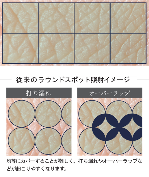 四角いスポットサイズ（スクエアスポット）