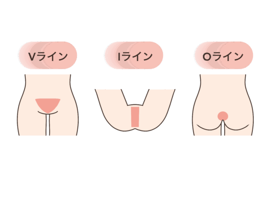 VラインIラインOライン